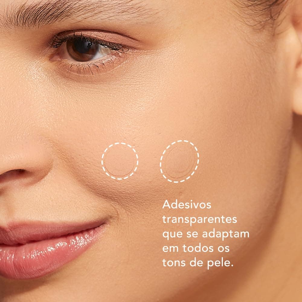 Océane Adesivos Secativos Para Espinhas com Ácido Salicílico - Acne Patches 22un thumbnail 5