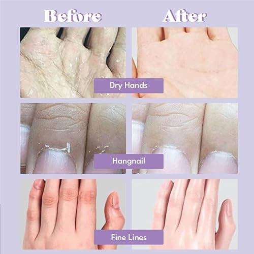Toi:L Extra Silky Hand Mask 5 Pairs, Korean Moisturizing Gloves for Dry Hands with White Truffle, Green Caviar & Peptides, Repairing and Softening Hand Care Treatment for Aging, Cracked, and Dry Skin thumbnail 3