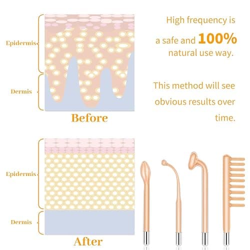 MYSWEETY High F Rrequncy Portable Handheld Facial Skin Care Wand Machine thumbnail 6