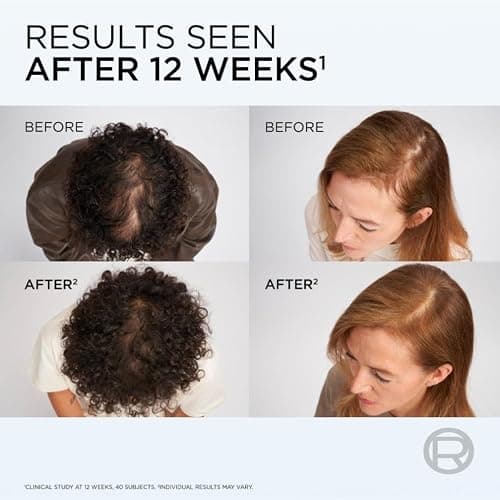 L'Oréal Paris Elvive Growth Booster Hair Growth Serum, Anti Hair Loss 102ml | With Aminexil, Niacinamide & Ginger Extract, Reduces Hair Loss & Boosts Density for Men & Women, Hair Loss Scalp Treatment thumbnail 5