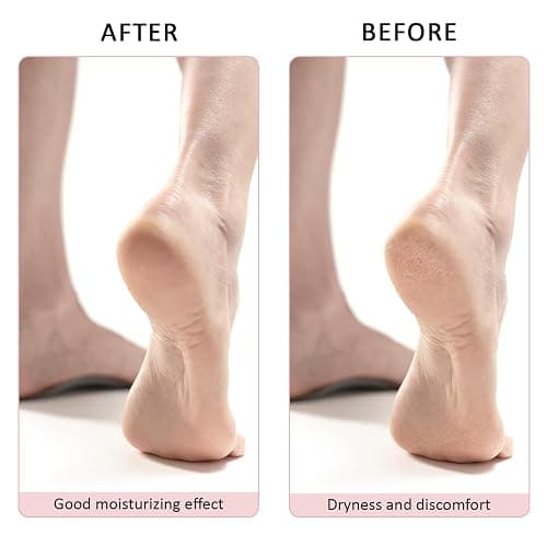 3 Pairs Aloe Socks, Aloe Infused Socks for Women, Fuzzy Moisturizing Socks, Spa Socks for Men, Lotion Socks Heel Socks for Dry Cracked Feet Women, Gel Socks Sleep Socks thumbnail 4