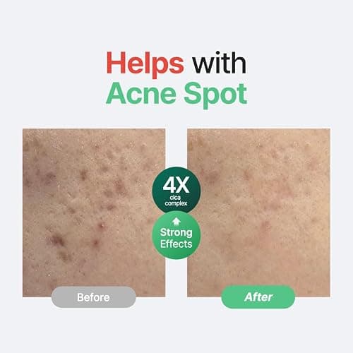 PURITO Centella Unscented Serum, 34,860 ppm Centella, Facial Serum for Sensitive Skin & Acne-Prone Skin, Soothing Serum, Vegan & Cruelty-Free, Korean Skincare, 2 fl.oz / 60ml thumbnail 3