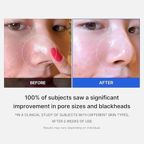 MEDICUBE Zero Pore Pad 2.0 thumbnail 5