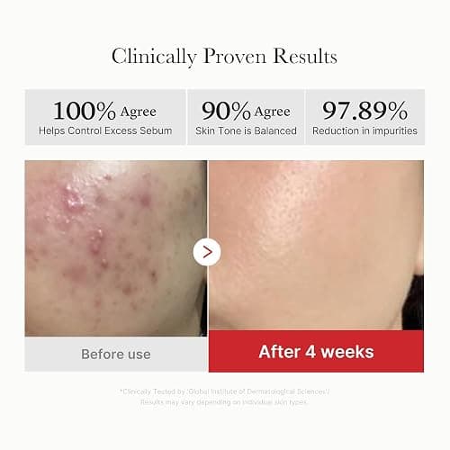 Medicube Red Succinic Acid Panthenol Facial Peeling Pads - Exfoliating Toner Pads for Breakout-Prone Skin with Niacinamide, AHA, BHA, and Soothing Panthenol - Non-Comedogenic thumbnail 4