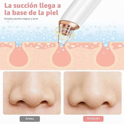 BUTBU Succionador de Puntos Negros, Limpiador de Poros Electrico Con 6 Cabezales y 3 Modos, 16 Piezas Limpiador de Poros Kit, para Eliminars Puntos Negros,Comedones y El Acné Graso thumbnail 8