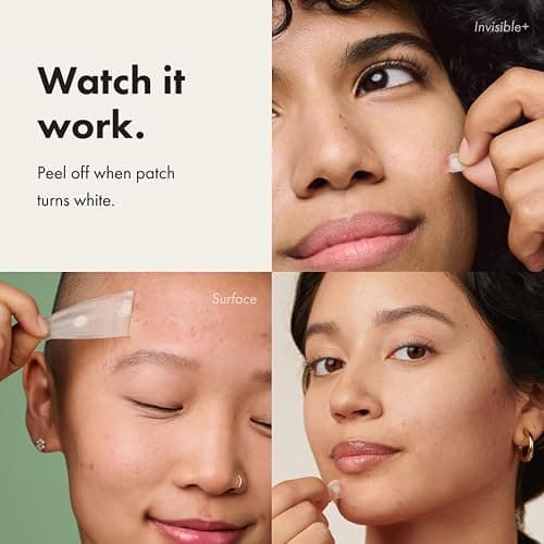 Mighty Patch™ Variety Pack from Hero Cosmetics - Hydrocolloid Acne Pimple Patches for Covering Zits and Blemishes, Spot Stickers for Face and Skin, Korean Skin Care, 26 ct thumbnail 4