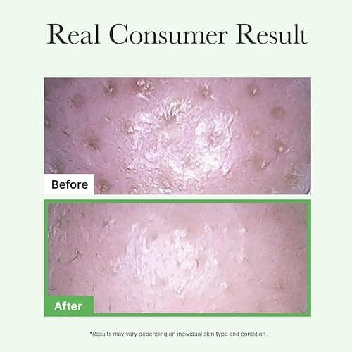 ARENCIA Pore Melt Mochi Makeup-Removing Cleansing Oil, Non-Comedogenic, Rice Amino Acids HD, Vitamin E, Cica, & Ceramide, 6.76 fl oz thumbnail 7