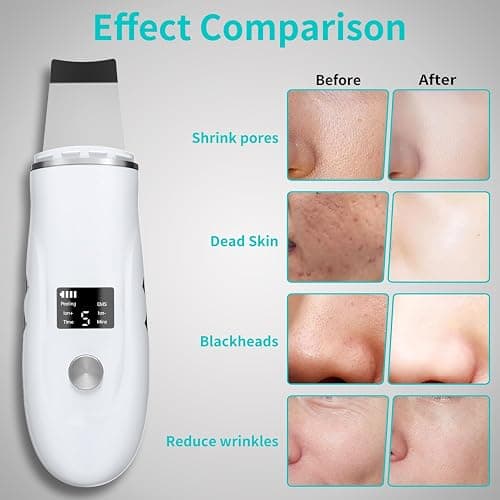 Face Scrubber Skin Spatula - Blackhead Remover Deep Cleansing Tool for Pore Extraction, 4-in-1 Fast Charging Dock Blackhead Remover Face Spatula for Facial Skincare Women Gift (White) thumbnail 3