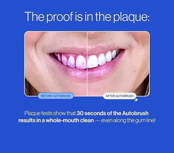 Autobrush Sonic Pro Electric Toothbrush – Only ADA Accepted U-Shaped Brush, Clinically Proven Up to 5.1X Better Cleaning, 30-Second Full Mouth 360 Clean, Rechargeable, Waterproof, Black, Men's Regular thumbnail 8