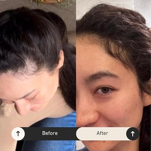 BUR BUR Growing Season Hair Growth And Repair Oil | With Burdock, Nettle Oil and Vitamin C for Visibly Fuller, Stronger and Shinier Hair. thumbnail 4