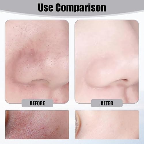 Peel Shot Glow Rice Ampoule, 2Pack White & Black Rice Gentle Exfoliant Scrub for Face & Body, Helps Clear Blackheads & Dead Skin, Pore Care, All Skin Types (100ml*2) thumbnail 6