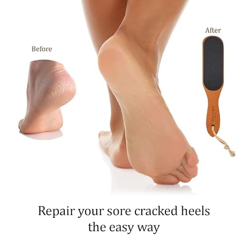 Pumice Stone Foot File - Wooden Pedicure Feet Scrubber with Handle for Callus, Dry, and Dead Skin Removal - Heel Scraper for Feet, Hands, and Body - Foot Filer for Use in Shower thumbnail 5
