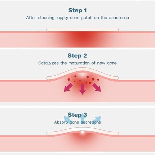 VENROCK Pimple Patches for face,24 Cute Pet Shapes 48 Count Hydrocolloid Acne Treatment for Covering Zits & Blemishes Spot for Kids & Adults, with Salicylic Acid, Tea Tree Oil, Centella Asiatica Oil thumbnail 5