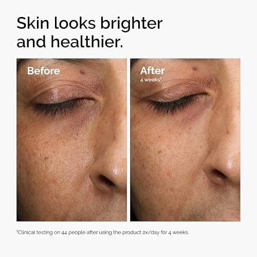 The Ordinary Multi-Antioxidant Radiance Serum, Vitamin C Serum For Face, Brighten & Protect Skin – Boosts Glow & Shields Against Environmental Stressors, 1 Fl Oz thumbnail 4