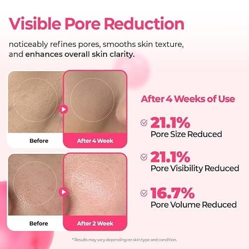 Dr.Melaxin Cemenrete Cyano Pink Spicule Serum with Calcium, korean skin care pore tightening refines spicule microneedling serum 1.01 fl. oz. thumbnail 7