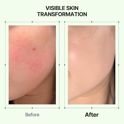 Orien Mugwort Zero Film Moisturizer 60ml Niacinamide 2% panthenol glycerin adenosine thumbnail 5