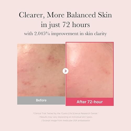 medicube TXA+Niacinamide 15% Glow Facial Serum for After Spot Care | All-in-One Daily Korean Skincare | Uneven Skin Tone, Texture, and Hydration Care | High-Potency Tranexamic Acid 5% | 1.01 fl.oz thumbnail 3