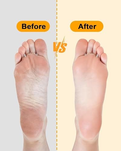 Foot Scrubber Pumice Stone for Feet: 4pcs Set Callus Remover for Women, Pedicure Tool for Smooth Cracked Heels & Dead Skin Care, Foot Grooming Home thumbnail 6