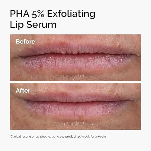 The Ordinary PHA 5% Exfoliating Lip Serum, Hydrating Overnight Lip Exfoliator Treatment, 0.5 Fl Oz thumbnail 2