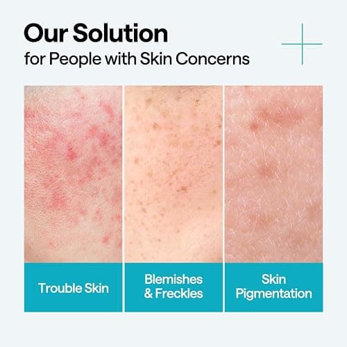 Mediheal Madecassoside Repair Serum 1.35 fl.oz - Blemish Care, Fades Pigmentation and Freckles & Skin Soothing & Hydration - with Centella Asiatica, Niacinamide thumbnail 4