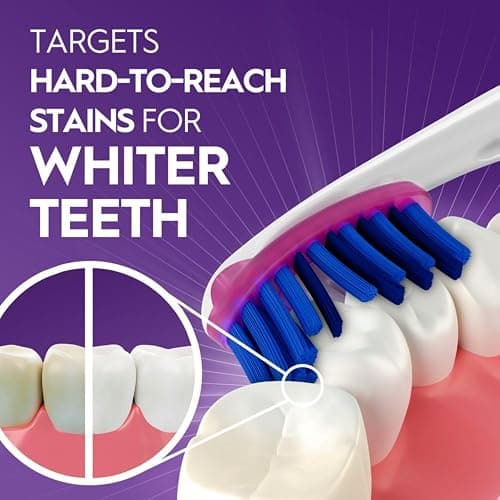 Oral-B 3D White Deep Stain Remover toothbrushes, 6 Count Toothbrush Soft, Removes 90% of Surface Stains, whitens Teeth, deep Reach, removes Plaque and Stains Tooth Brush thumbnail 3