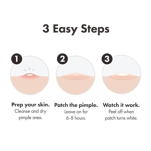 Mighty Patch Original Spot Patches by Hero Cosmetics, Day & Night Time Acne Treatment, Clear Spot Remover Hydrocolloid Patches, Anti Acne Dots, Spot Treatment Pimple Stickers - 72 Pimple Patches thumbnail 6