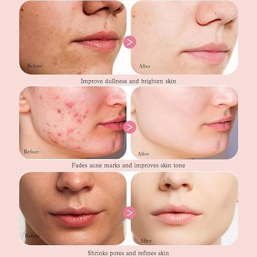 Peach 70 Niacinamide Serum, Dark Spot Correcting Serum for Face Hydrating, Facial Serum for Oily Skin, Daily Clean thumbnail 3