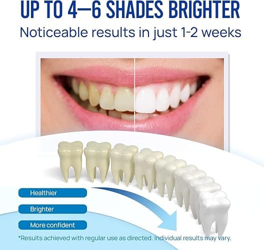 VieBeauti Teeth Whitening Pen (3 Pcs), 30+ Uses, Effective, Painless, No Sensitivity, Travel-Friendly, Easy to Use, Beautiful White Smile, Mint Flavor thumbnail 2