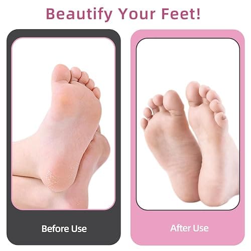 AprElm 4.8IN Longer Electric Foot Callus Remover with 80pcs Sandpaper Discs, Professional Aluminum Callus Remover for Feet, Stepless Speed Control Pedicure Tools for Dead Skin (Pink) thumbnail 6