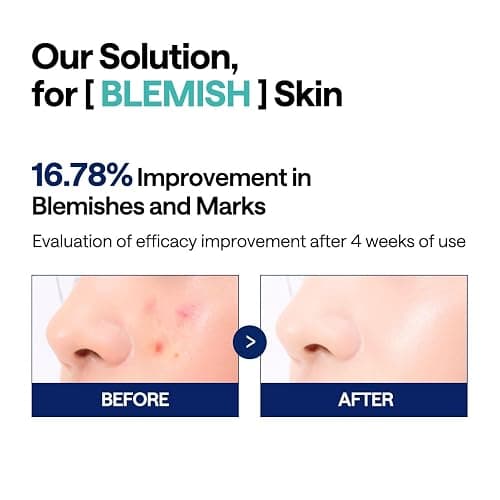 MEDIHEAL Madecassoside Blemish Pad - Square Cotton Facial Toner Pads with Centella Asiatica & Madecassoside – Anti Blemish to Improve Uneven Skin Tone - Vegan Face Gauze Pads, 100 thumbnail 4