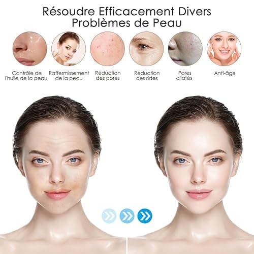 Dr. pen M8S Microneedling Pen Dermapen Stylo de Microneedling Professionnel Sans Fil Électrique avec Écran LCD et Chargement Type-C avec 7 Cartouches, Cadeaux pour Femmes, Mère, Petite Amie thumbnail 2