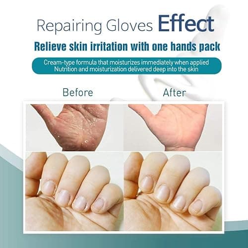 Epielle Intensive Repairing Hand Mask 6 Pairs, Deep Moisturizing Gloves for Dry, Cracked Hands, Self Care Gifts for Women, Spa Kit, Stocking Stuffers, Thanksgiving Essentials thumbnail 8