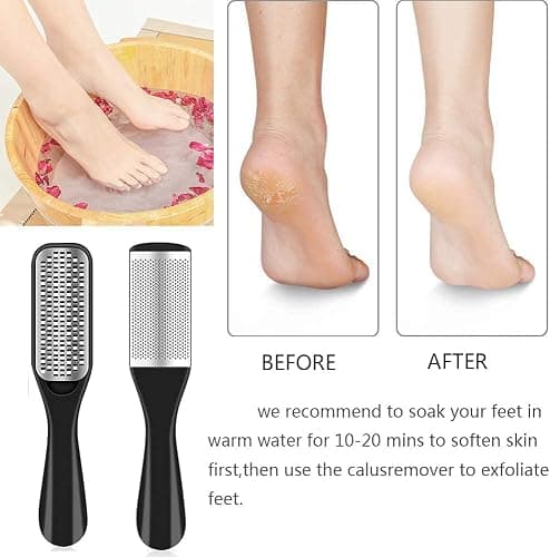 EKOCSIO Professional Pedicure Kit, 36 in 1 Stainless Steel Foot Care Kit Foot Rasp Dead Skin Remover for Home & Salon Care, Black thumbnail 4
