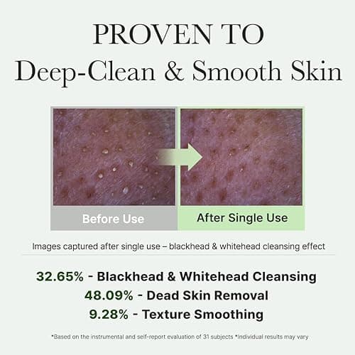 Arencia Korean Rice Mochi Face Cleanser - Face Mask, Foaming Cleanser, Gentle Scrub All in One - Deep Cleansing, Moisturizing, Pore Minimizing, Removing Blackhead- with Rice Water & Green Tea, Mugwort thumbnail 7