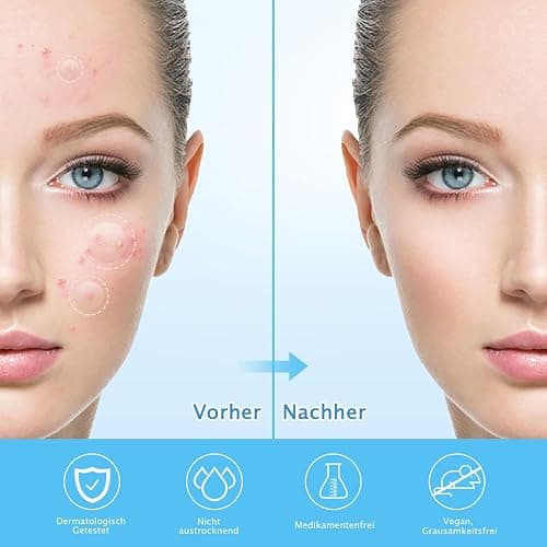 360 Stück Pickel Patch Hydrokolloid Acne Pimple Patches Anti-Akne Patch Unsichtbare für Tag & Nacht mit Teebaumöl, Salicylsäure,Centella Asiatica｜4 Größen 8 mm,10 mm,12 mm,14 mm thumbnail 4