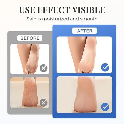 Hydrating and Anti-Cracking Foot Cream, 2025 Moisturising and Relieves Cracking and Dryness Foot Cream, Hand and Foot Repair Cream for Women & Men Callused, Feet, Knee, Elbow, Hand (White-1PC, #01) thumbnail 4