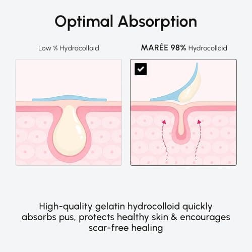 MAREE Invisible Pimple Patches 2 PACK - Clear Pimple Patches for Face - Hydrocolloid Acne Patches Anti Blemish - Zit Stickers for Face - Parches Para Acne - Pinple Zit Pimple Stickers - 144 Dots thumbnail 5