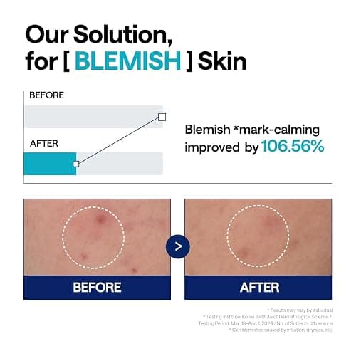 Mediheal Madecassoside Repair Serum 1.35 fl.oz - Blemish Care, Fades Pigmentation and Freckles & Skin Soothing & Hydration - with Centella Asiatica, Niacinamide thumbnail 7