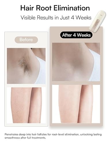 Laser Hair Removal Device for Women and Men, INIA Fond Hair Remover with Long-Lasting in Hair Reduction for Body&Face, Safe at-home Results for Armpits, Bikini and Legs thumbnail 4