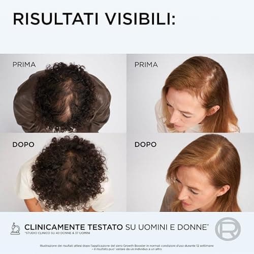 L'Oréal Paris Elvive Siero Cute Anti-Caduta, Per Capelli Tendenti alla Rottura, Rinforza i Capelli Esistenti e Ne Stimola la Crescita, Con Complesso Fortificante Aminexil-R, Growth Booster, 102 ml thumbnail 5