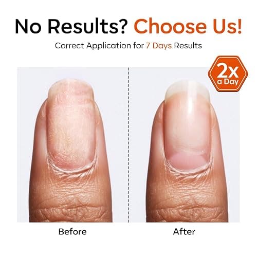 Modelones Nail Strengthener and Growth, Water-Based Nail Hardener Repair | Nail Hardener Extra Strong and Growth 3-in-1 Clear Nail Repair Mode Strengthening Polish Care Gifts Women 13.5ml 0.46 Fl Oz thumbnail 6