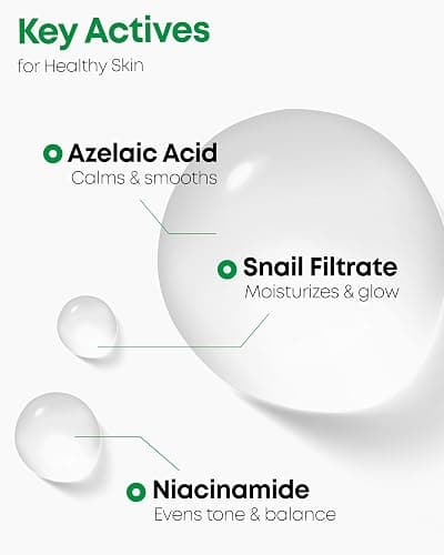 Nineless A-Control Azelaic Acid Toner with AHA & BHA - Pore Refining & Soothing Facial Toner for Acne-Prone Skin - Redness Relief & Dark Spot Corrector, Korean Skincare, 5.07 fl.oz thumbnail 3