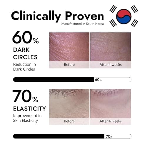 MIZON Under Eye Patches for Puffy Eyes & Dark Circles, 24K Gold & Snail Mucin, 60 Pcs – Anti-Wrinkle Collagen & Peptide Formula – Moisturizing Korean Eye Mask for Elasticity thumbnail 3