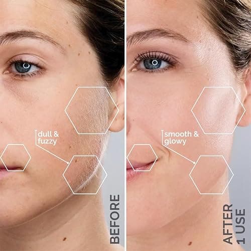 Michael Todd Beauty Sonicsmooth Pro+ Dermaplane Razor for Women Face + Eyebrow trimmer Dermaplaning System w/LED Light Peach Fuzz Remover -16 Dermaplaning Blades & 2 Microsmooth Exfoliation Tips thumbnail 4