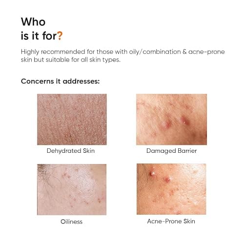 Minimalist Vitamin B5 10% Oil Free Fast Absorbing Lightweight Face Moisturiser Gel For Oily & Acne Prone Skin, 50 g (Pack of 1) thumbnail 3