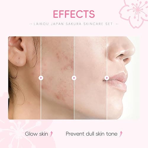 LAIKOU Skin Care Set JAPAN SAKURA Women Beauty Gift Sets Skin Care Kit 6pcs | Cleanser, Toner, Lotion, Serum, Eye Cream, Face Cream Travel Kit for Women Teen Girls Mom Daughter TSA-friendly Sizes thumbnail 4
