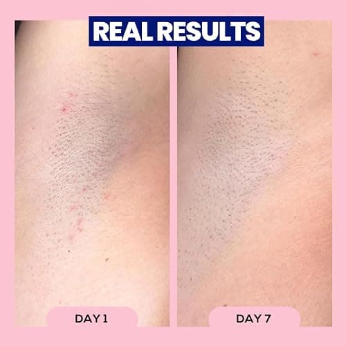 Megababe Après Shave | Post-Shave & Waxing | Ingrown Hair & Razor Bump Roll-On Treatment for Women | Bikini, Armpits & Legs (3.0 fl oz) thumbnail 6
