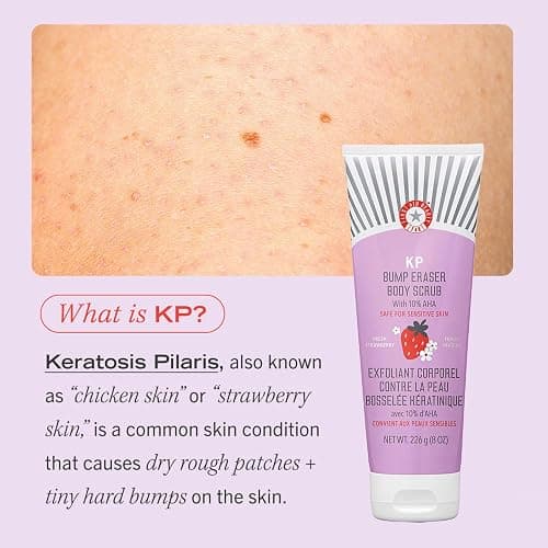 First Aid Beauty - KP Bump Eraser Body Scrub with 10% AHA, Keratosis Pilaris Exfoliator with Glycolic and Lactic acids, Helps Reduce Chicken Skin Bumps, Safe for Sensitive Skin, Strawberry Scent, 8 oz - Fresh Strawberry - 8 Ounce thumbnail 8