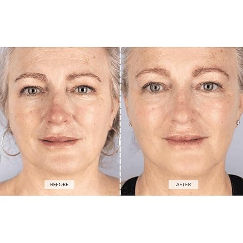 CurrentBody Skin LED Light Therapy Face Mask | Red Light Therapy Treatment Device | Anti-Aging Face Mask for Wrinkle Reduction thumbnail 3