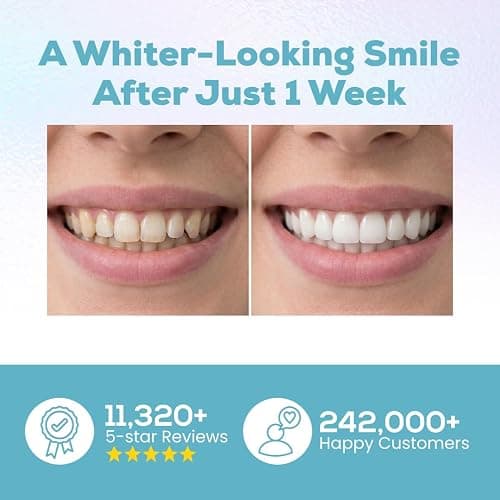 Venus Visage Teeth Whitening Pen and Tooth Polishing Kit (Pack of 2) – Professional Teeth Whitening Gel, 30+ Uses, Low Sensitivity, Enamel-Safe Mint Formula – Removes Coffee, Wine & Tobacco Stains thumbnail 2